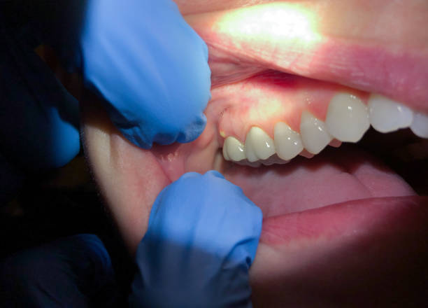 Best Emergency Cosmetic Dentistry in Franklin Lakes, NJ